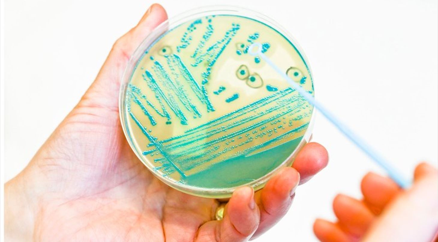 Mikrobiologi - en petri skål med vækst