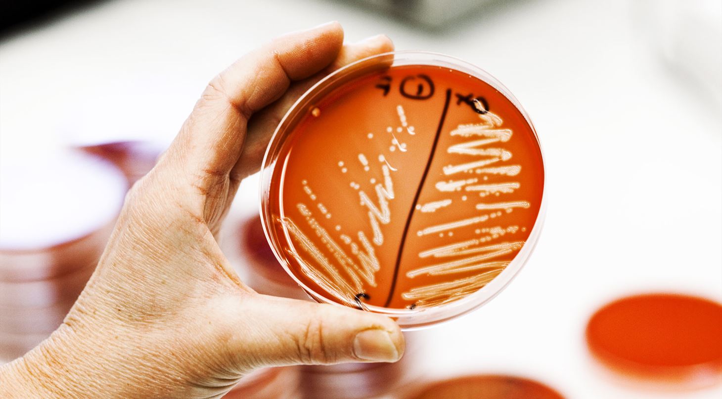 Mikro bio lab - novel proteins
