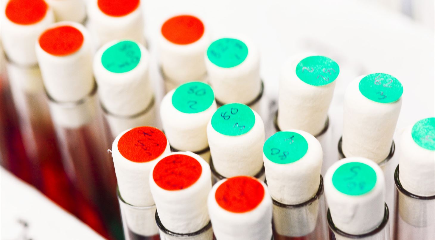 chemical analysis - novel proteins
