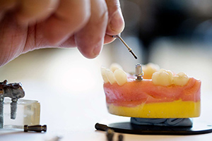 Dentalskrue s�ttes i gebis
